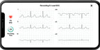 AliveCor KardiaMobile 6L Personal EKG Monitor, Black - KM-6L-E
